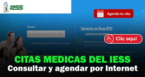 agenda de citas medicas iess|Agendar citas médicas en el IESS para afiliados o hijos